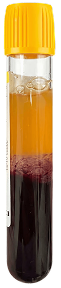 Selphyl® PRP Regenerative Medicine